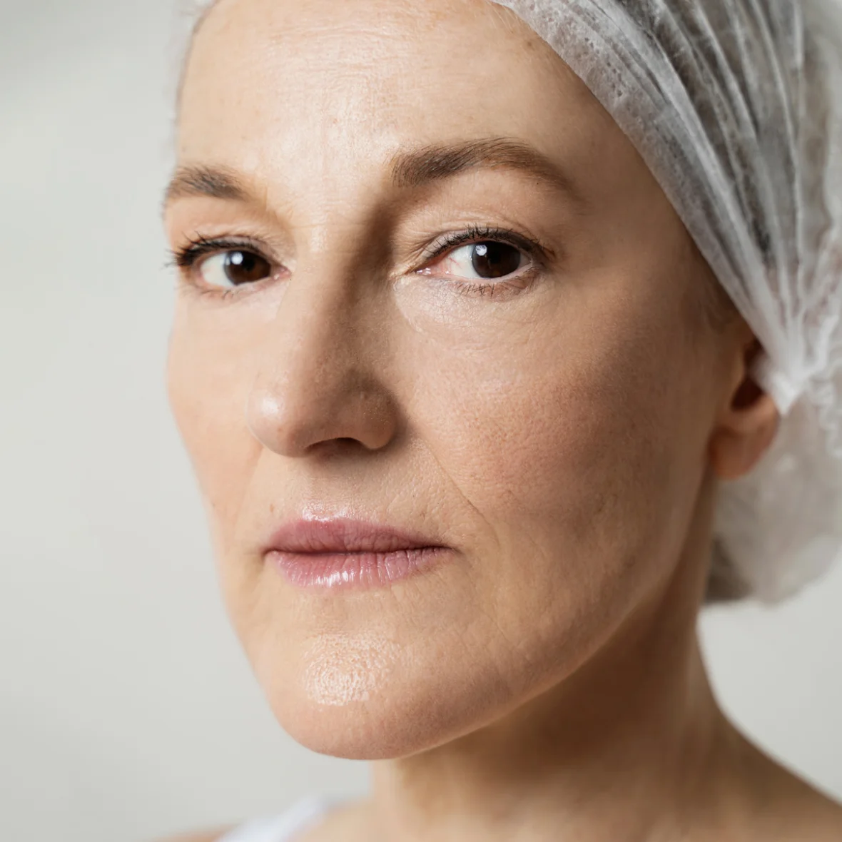 Client after treatment at Palma Aesthetics