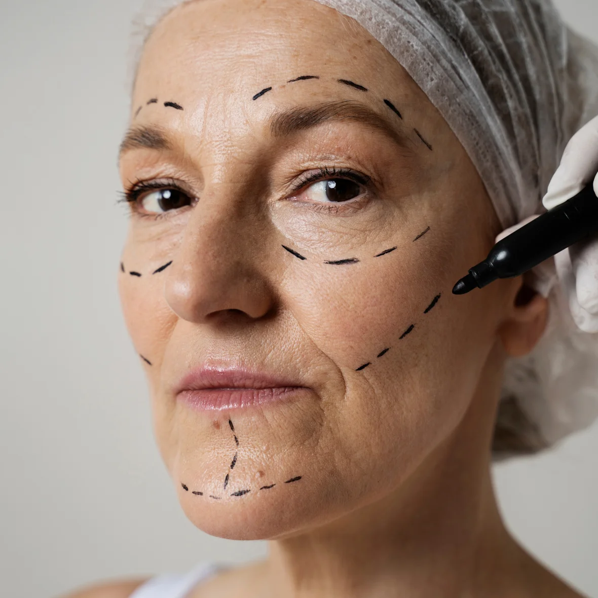 Client skin before