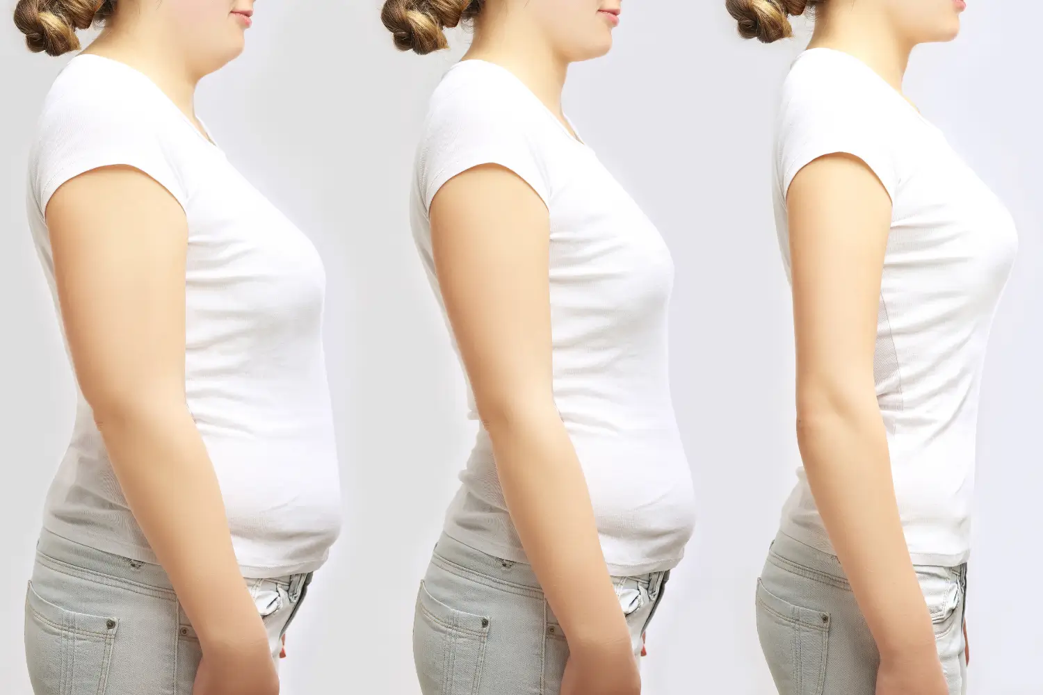 Three side-profile photos of a woman showing gradual weight loss