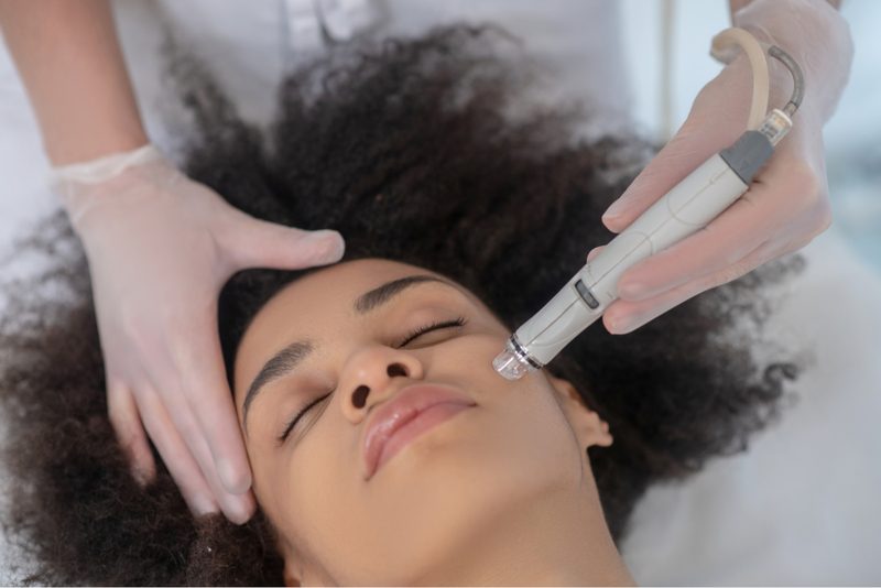 Microdermabrasion