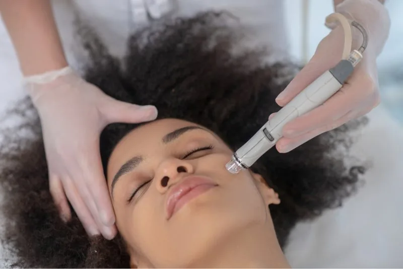 Microdermabrasion