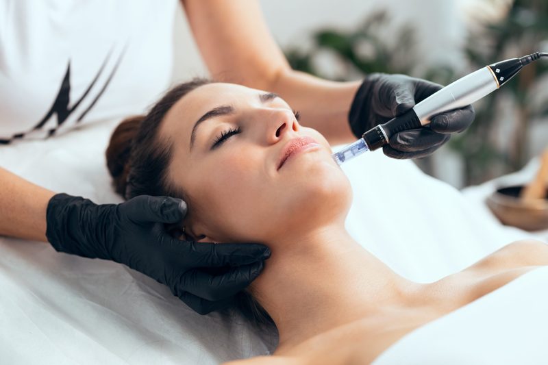 A radiofrequency microneedling device being worked along a client's jawline